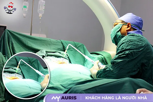 Bơm xi măng cột sống là một lựa chọn phổ biến cho các bệnh lý liên quan đến thoái hóa